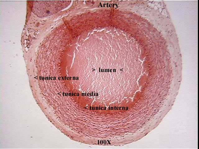 Artery 100x