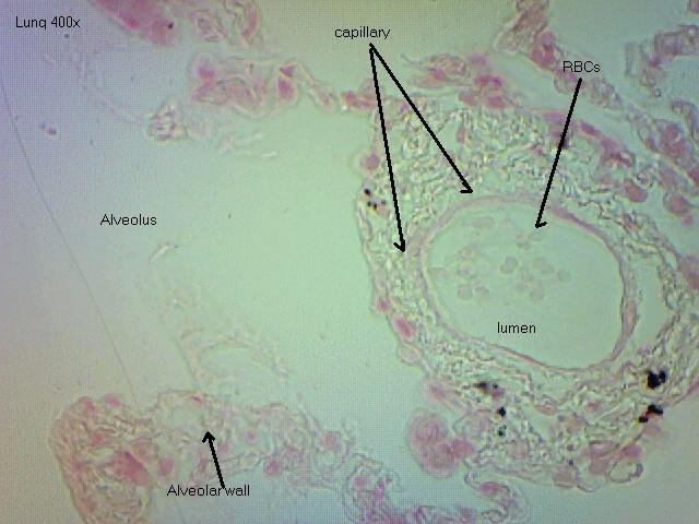 Lung 400x