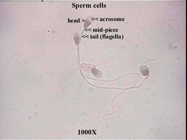 Sperm 1000x